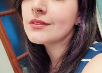 Madre herida al salvar a su hijo en incendio llegó de urgencia a Santiago y requiere dadores de sangre