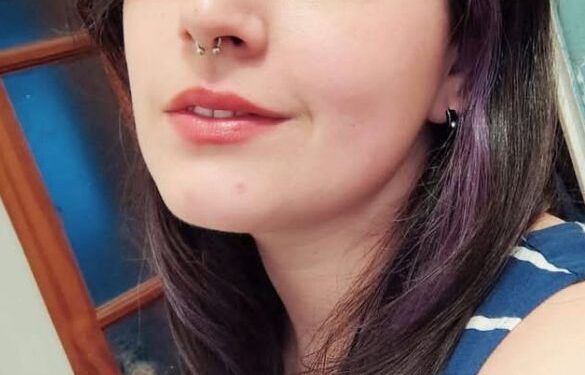 Madre herida al salvar a su hijo en incendio llegó de urgencia a Santiago y requiere dadores de sangre