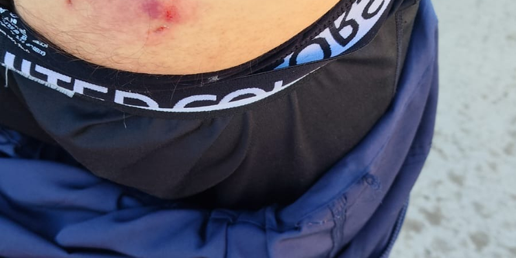 Dos trabajadores del personal de recolección de residuos fueron mordidos por perros en Punta Arenas